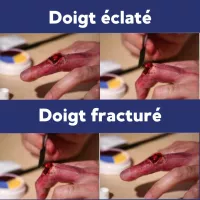 Simulation de doigt coupé