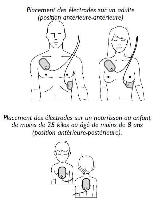 Electrodes